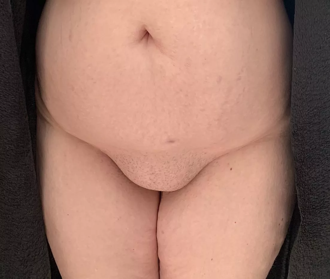 Love My Wifes Belly And Fupa Nudes Bbwmilf Nude Pics Org