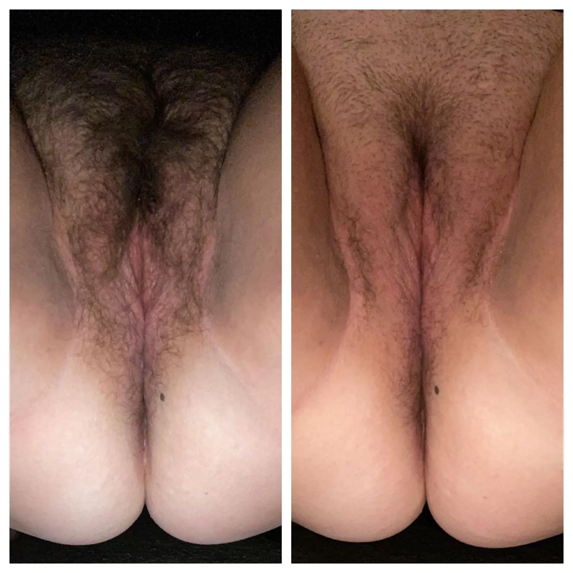 Before And After With A Trimmer F Nudes Normalnudes Nude