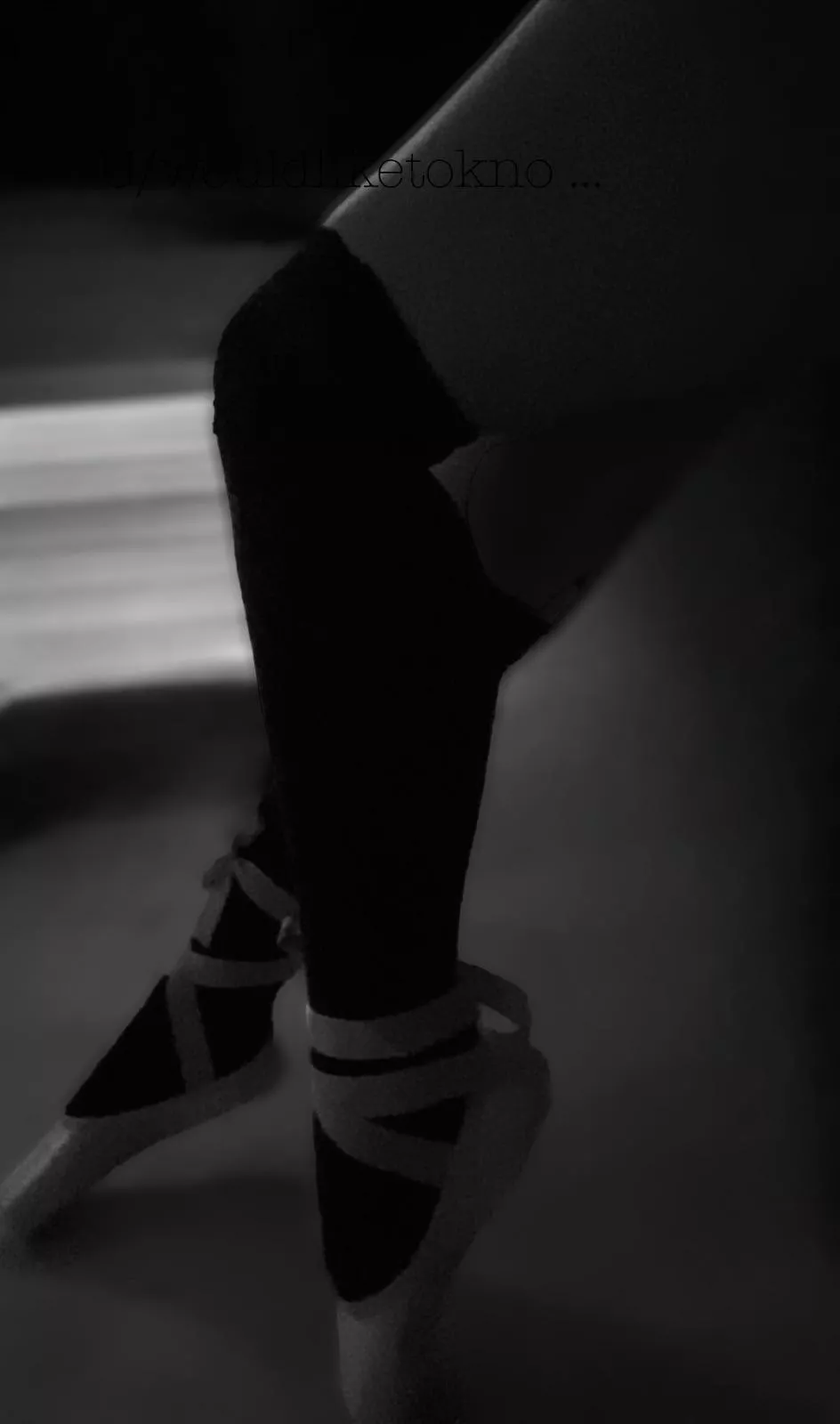 Legs