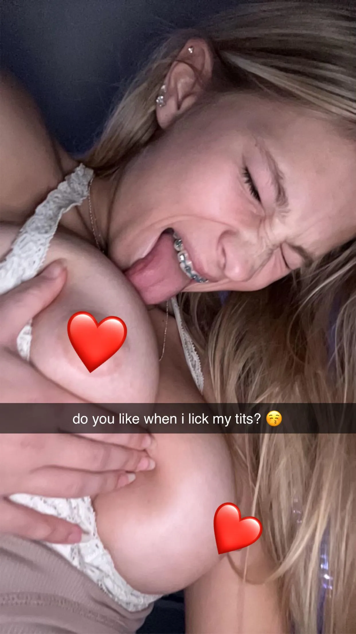 do you prefer my boobs or braces 